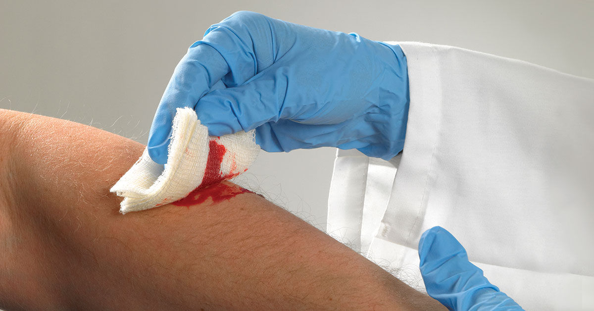 Medical professional applying a bandage to a bleeding arm, illustrating potential bloodborne pathogens exposure during first aid response.