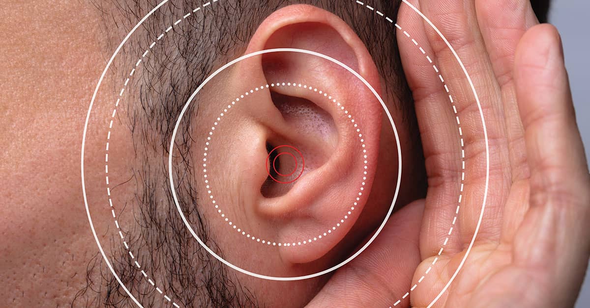 When a hearing loss is a Standard Threshold Shift